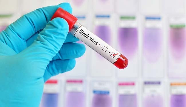 Kerala Nipah Virus: कोझिकोड में नियंत्रण क्षेत्र, कन्नूर, वायनाड और मलप्पुरम में अलर्ट जारी